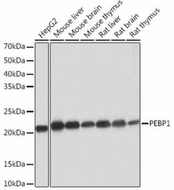 RKIP/PBP Rabbit anti-Human, Mouse, Rat, Clone: 1X2G1, Novus Biologicals:Antibodies:Primary