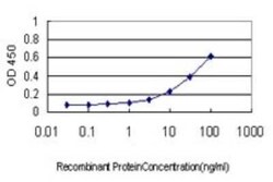 RKIP/PBP Antibody (1D3-1B6), Novus Biologicals 0.1 mg | Buy Online | Novus Biologicals | Fisher Scientific