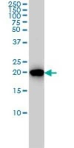RKIP/PBP Antibody (1D3-1B6), Novus Biologicals 0.1 mg | Buy Online | Novus Biologicals | Fisher Scientific