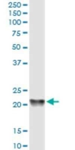 RKIP/PBP Antibody (2G2-1F1), Novus Biologicals 0.1 mg | Buy Online | Novus Biologicals | Fisher Scientific
