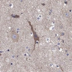 RLBP1L1 Rabbit anti-Human, Polyclonal, Novus Biologicals 25 &mu;g | Buy Online | Novus Biologicals | Fisher Scientific