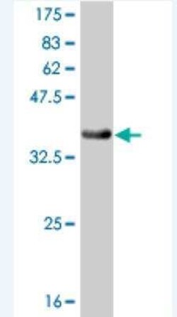 RLK/TXK Antibody (2G3), Novus Biologicals 0.1 mg | Buy Online | Novus Biologicals | Fisher Scientific