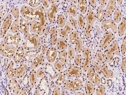 RMND5B Antibody, Novus Biologicals 50 &mu;g, Unconjugated:Antibodies, Polyclonal