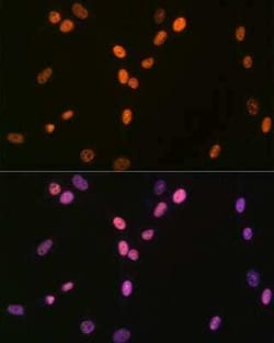 RNA Helicase A Rabbit anti-Human, Mouse, Rat, Clone: 2I6C5, Novus Biologicals&trade;