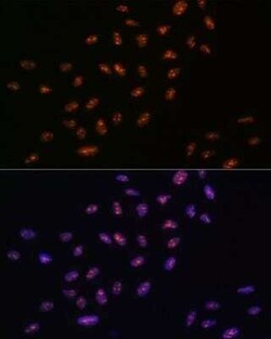 RNA Helicase A Rabbit anti-Human, Mouse, Rat, Clone: 2I6C5, Novus Biologicals:Antibodies:Primary