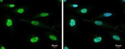 RNA Helicase A Antibody, Novus Biologicals 100 &mu;g; Unconjugated:Antibodies,