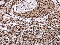 RNA Helicase A Antibody, Novus Biologicals 100 &mu;g; Unconjugated:Antibodies,