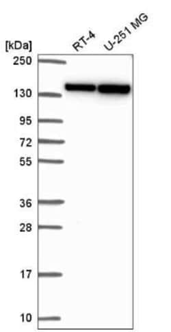 RNA Helicase A Antibody, Novus Biologicals 25ul; Unconjugated:Antibodies,