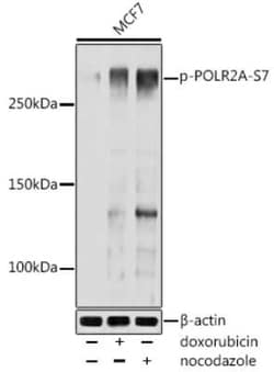 RNA Polymerase II/POLR2A Rabbit anti-Human, Mouse, Polyclonal, Novus Biologicals