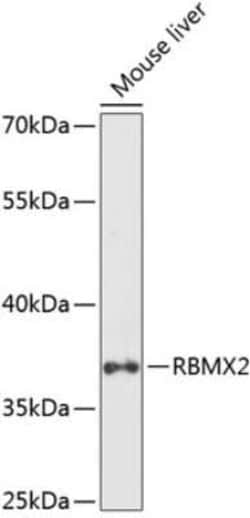 RNA binding motif protein, X-linked 2 Antibody - Azide and BSA Free, Novus