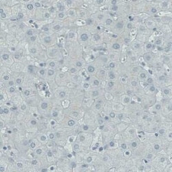 RNASE7 Antibody (CL0223), Novus Biologicals 25 &mu;L, Unconjugated:Antibodies,