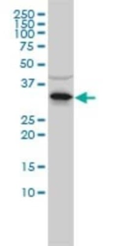 RNASEH2A Antibody (3G5-F5), Novus Biologicals 0.1 mg, Unconjugated:Antibodies,