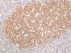 RNASEH2B Rabbit anti-Human, Clone: RM433, Novus Biologicals 100 &mu;g;