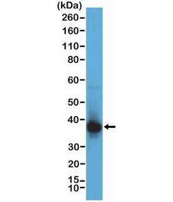 RNASEH2B Rabbit anti-Human, Clone: RM433, Novus Biologicals 100 &mu;g;