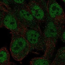 RNF113A Antibody, Novus Biologicals 100 &mu;g; Unconjugated:Antibodies,