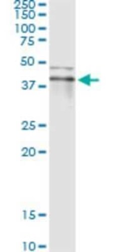 RNF113B Antibody (2B11), Novus Biologicals 0.1 mg | Buy Online | Novus Biologicals | Fisher Scientific