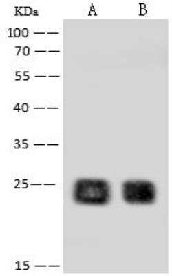RNF114 Antibody, Novus Biologicals:Antibodies:Primary Antibodies