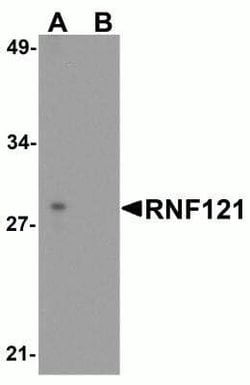 RNF121 Antibody - BSA Free, Novus Biologicals 0.1 mg; Unconjugated:Antibodies,