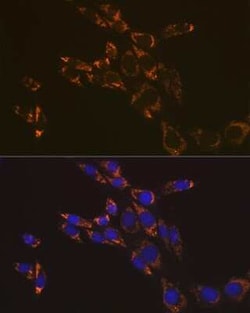 RNF126 Rabbit anti-Human, Mouse, Rat, Polyclonal, Novus Biologicals:Antibodies:Primary