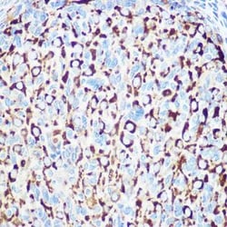 RNF126 Rabbit anti-Human, Mouse, Rat, Polyclonal, Novus Biologicals:Antibodies:Primary