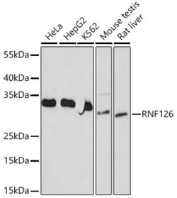 RNF126 Rabbit anti-Human, Mouse, Rat, Polyclonal, Novus Biologicals:Antibodies:Primary