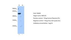 RNF135 Antibody, Novus Biologicals 100 &mu;L; Unconjugated:Antibodies,