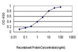 RNF139 Antibody (3D10), Novus Biologicals 0.1 mg | Buy Online | Novus Biologicals | Fisher Scientific