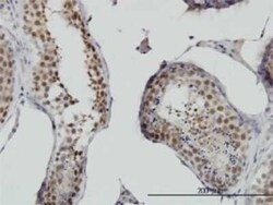RNF141 Antibody (6D9), Novus Biologicals 0.1 mg | Buy Online | Novus Biologicals | Fisher Scientific