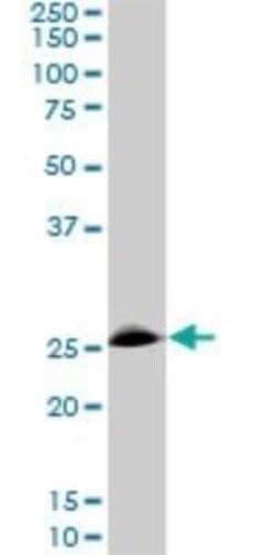 RNF141 Antibody (6D9), Novus Biologicals 0.1 mg | Buy Online | Novus Biologicals | Fisher Scientific