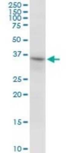 RNF144A Antibody, Novus Biologicals 50 &mu;g | Buy Online | Novus Biologicals | Fisher Scientific