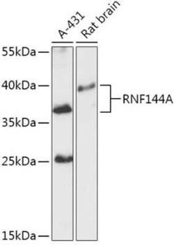 RNF144A Antibody - Azide and BSA Free, Novus Biologicals:Antibodies:Primary