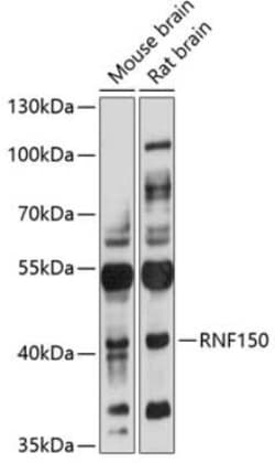 RNF150 Antibody - Azide and BSA Free, Novus Biologicals 0.02 mL; Unconjugated:Antibodies,
