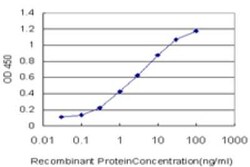 RNF151 Antibody (4G8), Novus Biologicals 0.1 mg; Unconjugated:Antikörper