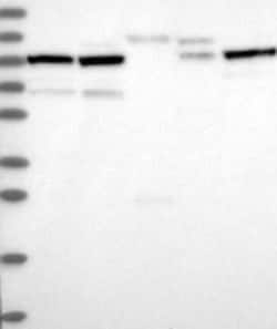 RNF169 Rabbit anti-Human, Polyclonal, Novus Biologicals 100 &mu;g; Unconjugated:Antibodies,