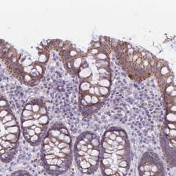 RNF170 Antibody, Novus Biologicals 25 &mu;L, Unconjugated:Antibodies, Polyclonal
