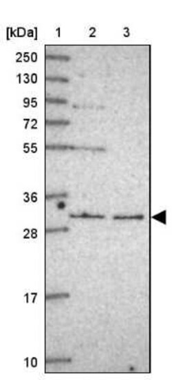 RNF170 Antibody, Novus Biologicals 25 &mu;L, Unconjugated:Antibodies, Polyclonal