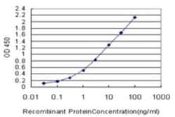 RNF181 Antibody (5A7), Novus Biologicals 0.1 mg | Buy Online | Novus Biologicals | Fisher Scientific