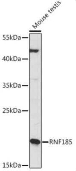 RNF185 Antibody - Azide and BSA Free, Novus Biologicals 0.1 mL; Unconjugated:Antibodies,