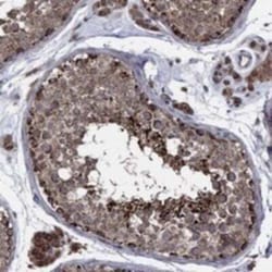 RNF19B Rabbit anti-Human, Polyclonal, Novus Biologicals 25 &mu;g; Unconjugated:Antibodies,