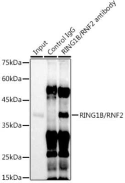 RNF2 Rabbit anti-Human, Mouse, Rat, Clone: 9Q2W2, Novus Biologicals 100