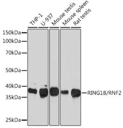 RNF2 Rabbit anti-Human, Mouse, Rat, Clone: 9Q2W2, Novus Biologicals 100