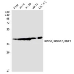 RNF2 Rabbit anti-Human, Mouse, Rat, Clone: S04-2B3, Novus Biologicals 25 &mu;g | Buy Online | Novus Biologicals | Fisher Scientific