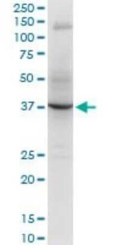 Novus Biologicals RNF2 Antibody (2B6), Novus Biologicals 0.1 mg | Buy Online | Novus Biologicals&trade; | Fisher Scientific