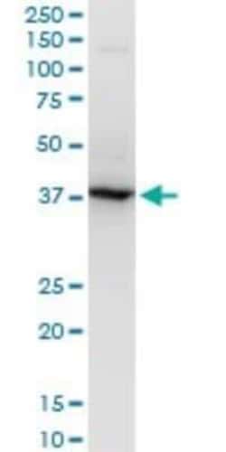 Novus Biologicals RNF2 Antibody (2B6), Novus Biologicals 0.1 mg | Buy Online | Novus Biologicals&trade; | Fisher Scientific