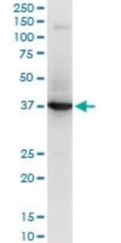 Novus Biologicals RNF2 Antibody (2B6), Novus Biologicals 0.1 mg | Buy Online | Novus Biologicals&trade; | Fisher Scientific