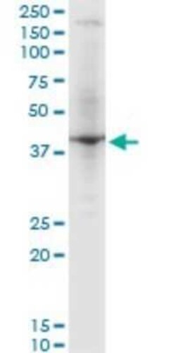 RNF2 Antibody (3G6), Novus Biologicals 0.1 mg | Buy Online | Novus Biologicals | Fisher Scientific