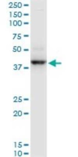 RNF2 Antibody (3G6), Novus Biologicals 0.1 mg | Buy Online | Novus Biologicals | Fisher Scientific