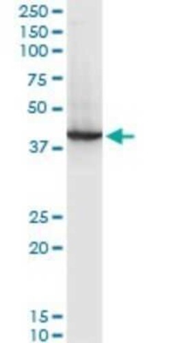 RNF2 Antibody (3G6), Novus Biologicals 0.1 mg | Buy Online | Novus Biologicals | Fisher Scientific