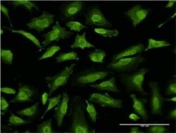 RNF2 Antibody (4A9), Novus Biologicals 0.1 mg | Buy Online | Novus Biologicals | Fisher Scientific