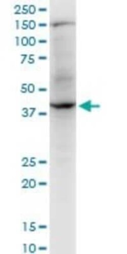 RNF2 Antibody (4A9), Novus Biologicals 0.1 mg | Buy Online | Novus Biologicals | Fisher Scientific
